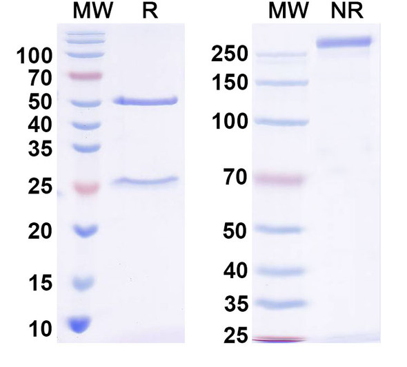 Anti-MMACHC Recombinant Monoclonal Antibody (N230/8) - SDS-PAGE
