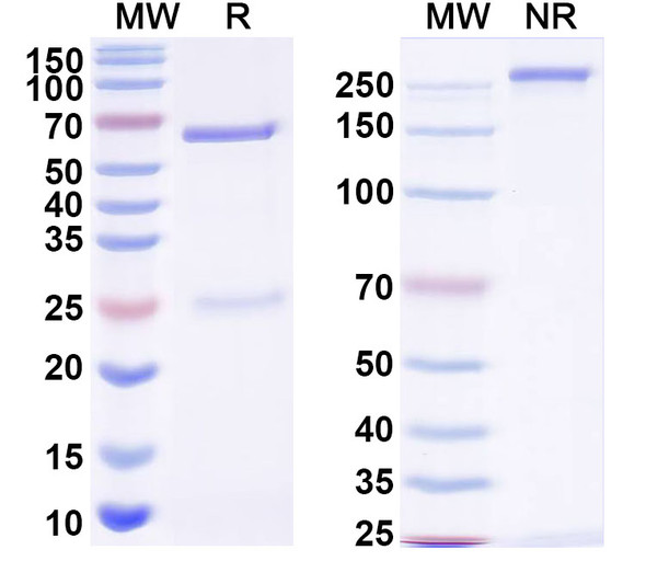 Anti-Gamma-protocadherin-A3 Recombinant Monoclonal Antibody (N144/17) - SDS-PAGE