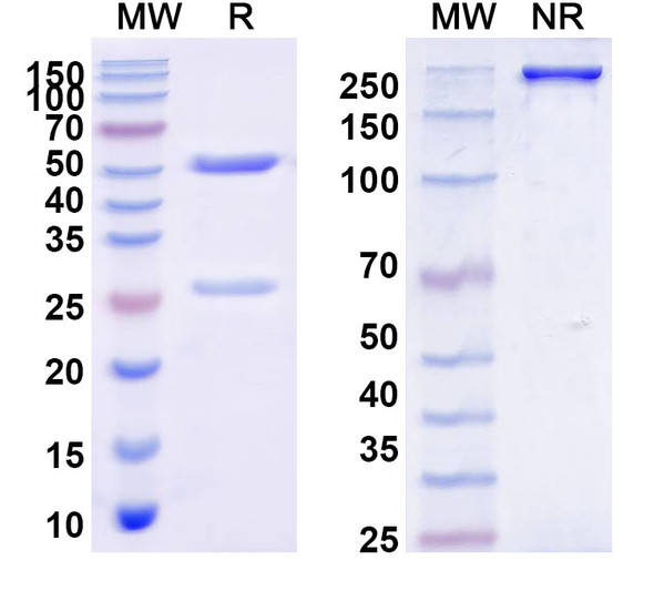 Anti-MiRP2 K+ channel Recombinant Monoclonal Antibody (N78/6) - SDS-PAGE