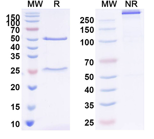 Anti-NBC/SLC4A4 Recombinant Monoclonal Antibody (N224/3) - SDS-PAGE
