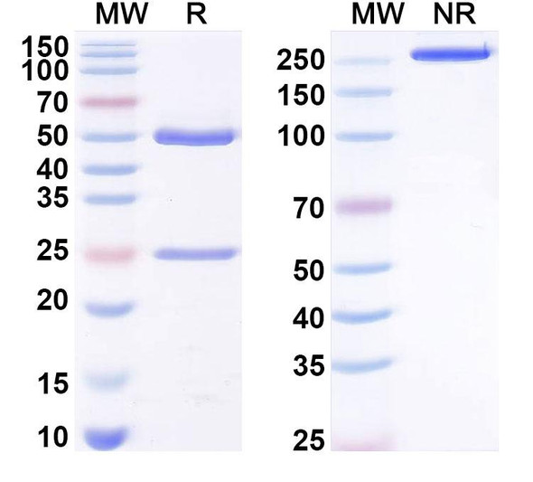 Anti-T3/Liothyronine Recombinant Monoclonal Antibody (SAA2030) - SDS-PAGE
