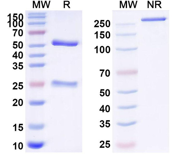 Anti-Human MAP3K2 Recombinant Monoclonal Antibody (E6#) - SDS-PAGE