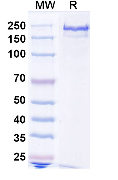 Anti-Human ATTR/Transthyretin amyloidosis Recombinant Monoclonal Antibody (NI301A) - SDS-PAGE