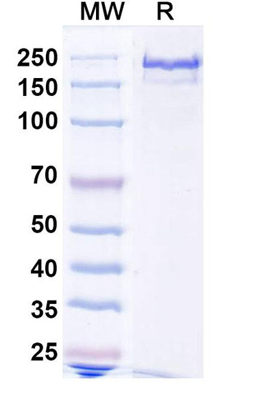 Anti-Human ATTR/Transthyretin amyloidosis Recombinant Monoclonal Antibody (NI301A) - SDS-PAGE