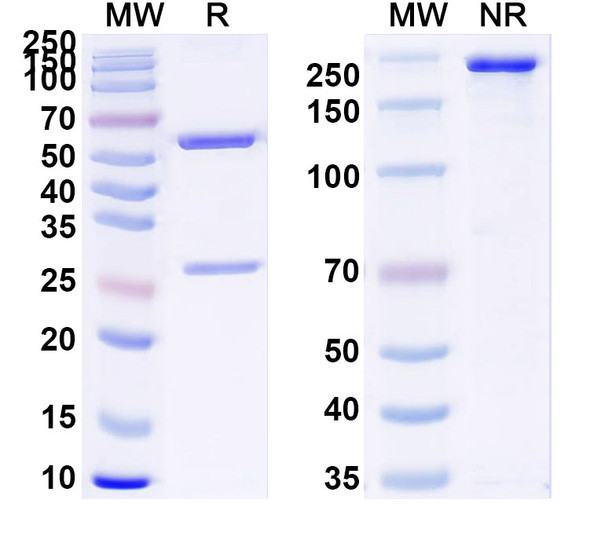 Anti-Human CTSB Recombinant Monoclonal Antibody (2A2) - SDS-PAGE