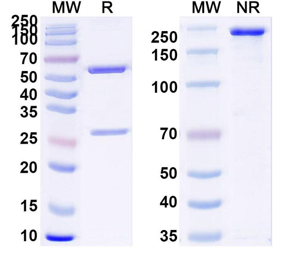 Anti-Human CTSB Recombinant Monoclonal Antibody (2A2) - SDS-PAGE