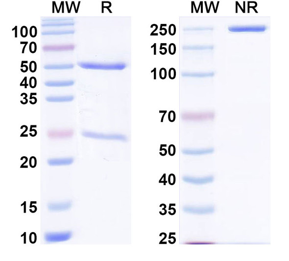 Anti-Human HRAS Recombinant Monoclonal Antibody (Y13-259) - SDS-PAGE