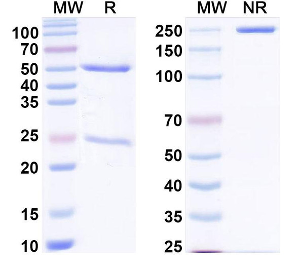 Anti-Human HRAS Recombinant Monoclonal Antibody (Y13-259) - SDS-PAGE