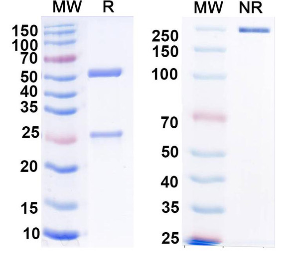 Anti-Monkeypox virus/MPXV H3L Recombinant Monoclonal Antibody (SAA0282) - SDS-PAGE