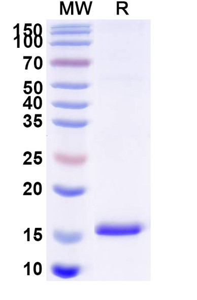 Anti-Sahara scorpion AaH I/Neurotoxin I Recombinant Nanobody (SAA2037) - SDS-PAGE