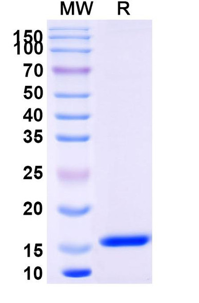Anti-Sahara scorpion AaH II/Neurotoxin II Recombinant Nanobody (SAA2039) - SDS-PAGE