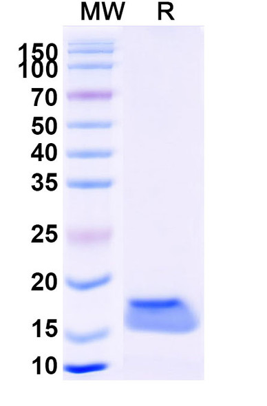 Anti-Sahara scorpion AaH II/Neurotoxin II Recombinant Nanobody (SAA2040) - SDS-PAGE