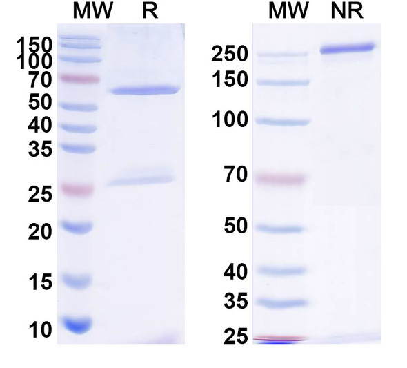 Anti-Bacillus anthracis PAD2 Recombinant Monoclonal Antibody (F20G75) - SDS-PAGE