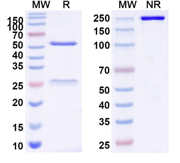 Anti-Bacillus anthracis cya/EF/Edema factor Recombinant Monoclonal Antibody (A4) - SDS-PAGE