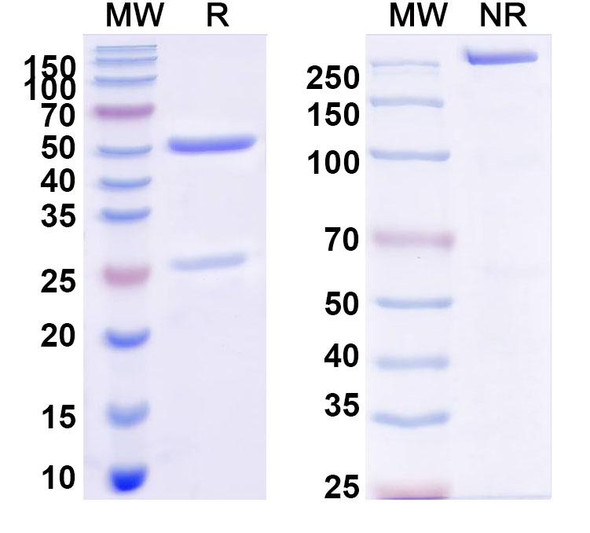 Anti-Mexican scorpion Toxin 2/Cn2 Recombinant Monoclonal Antibody (LR) - SDS-PAGE