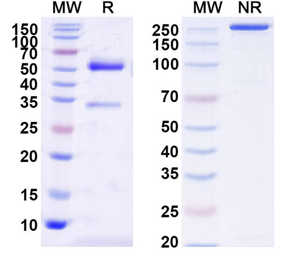Anti-Clostridium botulinum HA-33/Hemagglutinin 33 Recombinant Monoclonal Antibody (HA33) - SDS-PAGE