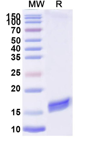 Anti-Bacteriophage H19B stxB/SLT-1b/VT1 Recombinant Nanobody (7-2#) - SDS-PAGE