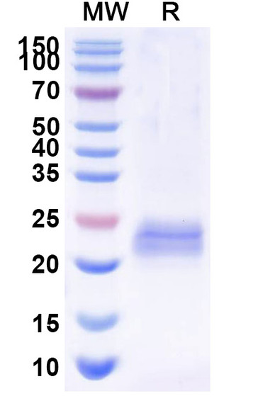 Anti-Bacteriophage 933W stxB2/SLT-2b/VT2 Recombinant Nanobody (Nb113) - SDS-PAGE