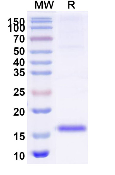 Anti-Escherichia coli Shiga toxin 2 subunit B/stx2eB Recombinant Nanobody (SAA2044) - SDS-PAGE