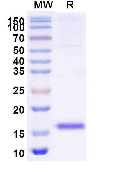 Anti-Escherichia coli Shiga toxin 2 subunit B/stx2eB Recombinant Nanobody (SAA2044) - SDS-PAGE