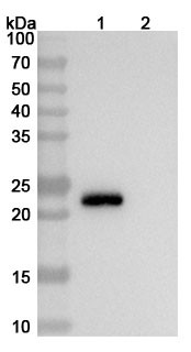 Anti-Escherichia coli O157:H7 shiga toxin type 1 B/stx1B Recombinant Monoclonal Antibody (5-5B) - WB