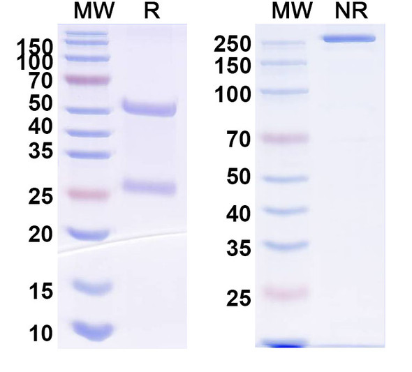 Anti-Microcystis aeruginosa Microcystin-LR Recombinant Monoclonal Antibody (3A8) - SDS-PAGE