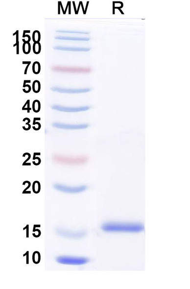 Anti-Human CFH Recombinant Nanobody (SAA2038) - SDS-PAGE