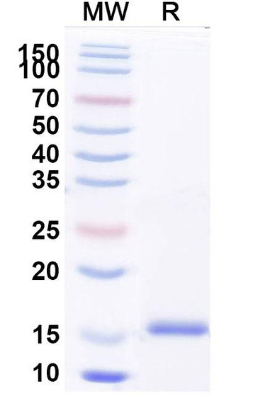 Anti-Human CFH Recombinant Nanobody (SAA2038) - SDS-PAGE