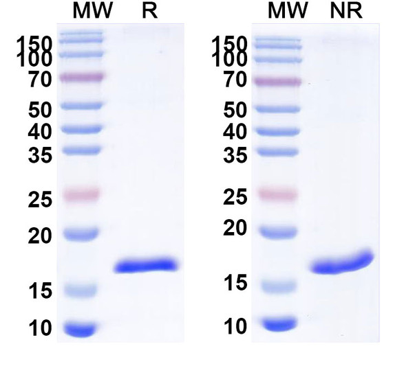Anti-Human CD70 Recombinant Nanobody (SAA2049) - SDS-PAGE
