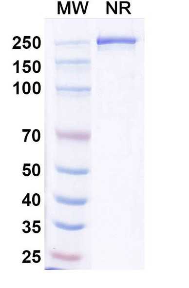 Anti-Human CD25/IL2RA Recombinant Monoclonal Antibody (BA9) - SDS-PAGE