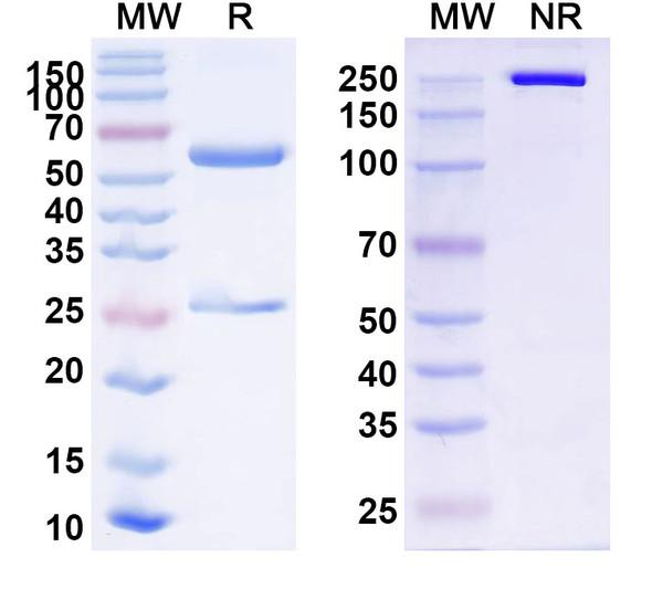 Anti-Human ROR1/NTRKR1 Recombinant Monoclonal Antibody (XBR1-402) - SDS-PAGE