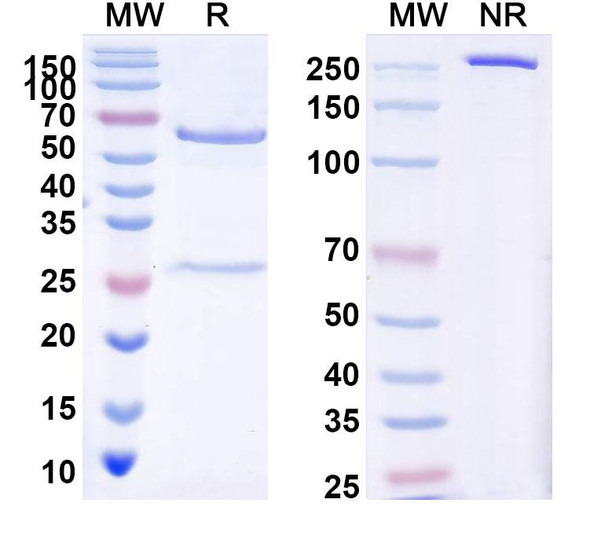 Anti-Human ROR1/NTRKR1 Recombinant Monoclonal Antibody (4C10) - SDS-PAGE