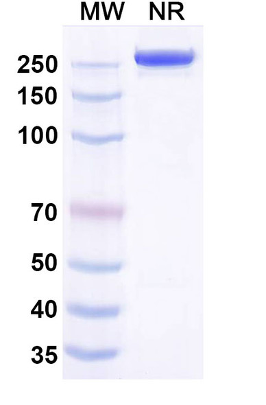 Anti-DENV-1 Envelope protein E Recombinant Monoclonal Antibody (14c10) - SDS-PAGE