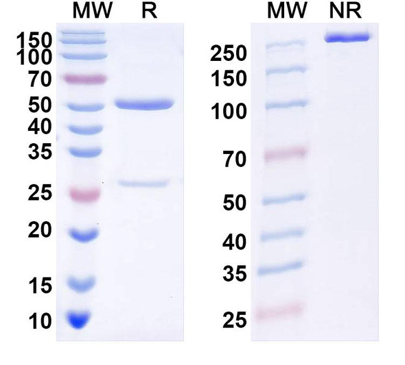 Anti-DENV-1 Envelope protein E Recombinant Monoclonal Antibody (50-11E) - SDS-PAGE