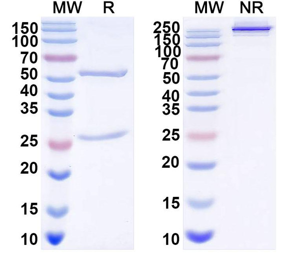 Anti-DENV-2 Envelope protein E/EDII fusion loop Recombinant Monoclonal Antibody (E28#) - SDS-PAGE