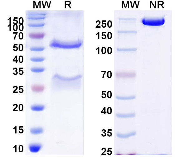 Anti-DENV-2 Envelope protein E/EDE2 Recombinant Monoclonal Antibody (B7) - SDS-PAGE