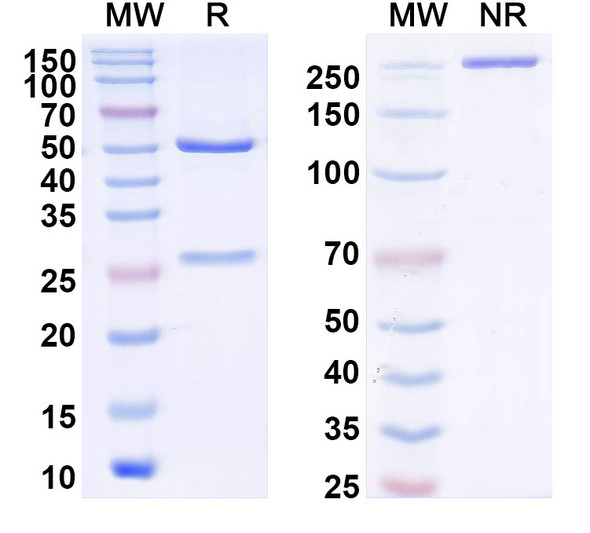 Anti-DENV-1/2/3/4 Envelope protein E/EDIII A strand Recombinant Monoclonal Antibody (4E11#) - SDS-PAGE