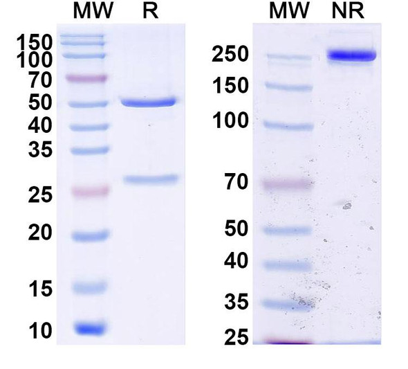 Anti-DENV-2 NS1 Recombinant Monoclonal Antibody (DENV2P9) - SDS-PAGE