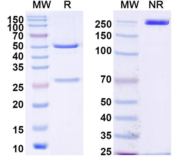 Anti-DENV-2 NS1 Recombinant Monoclonal Antibody (DENV2P2) - SDS-PAGE