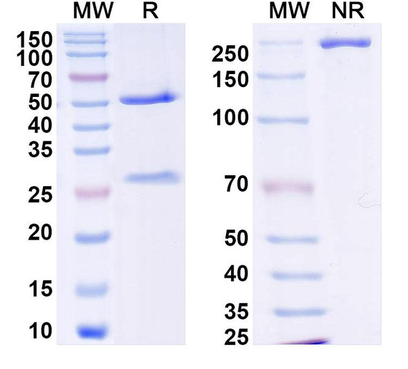 Anti-DENV-2 NSP5/NS5 Recombinant Monoclonal Antibody (4A1) - SDS-PAGE