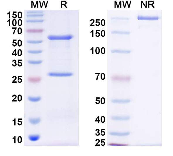 Anti-DENV-2 NSP5/NS5 Recombinant Monoclonal Antibody (1D7) - SDS-PAGE