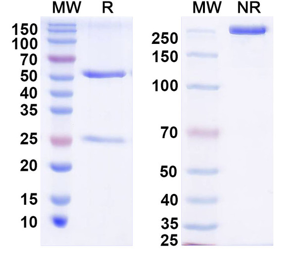 Anti-Suid herpesvirus 1/SuHV-1 UL42/PAP Recombinant Monoclonal Antibody (7C11) - SDS-PAGE