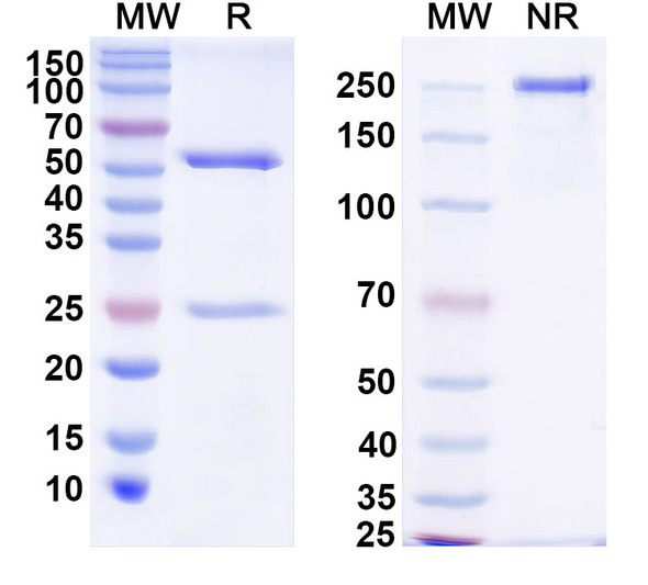 Anti-Suid herpesvirus 1/SuHV-1 UL42/PAP Recombinant Monoclonal Antibody (8F9) - SDS-PAGE