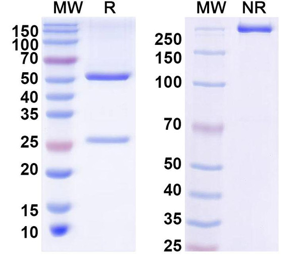 Anti-Influenza A virus (H5N1) HA/Hemagglutinin Recombinant Monoclonal Antibody (SAA2067) - SDS-PAGE