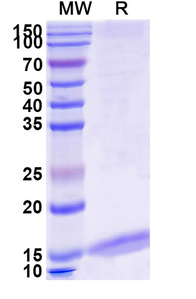 Anti-Mouse Albumin/Alb Recombinant Nanobody (MSA21) - SDS-PAGE
