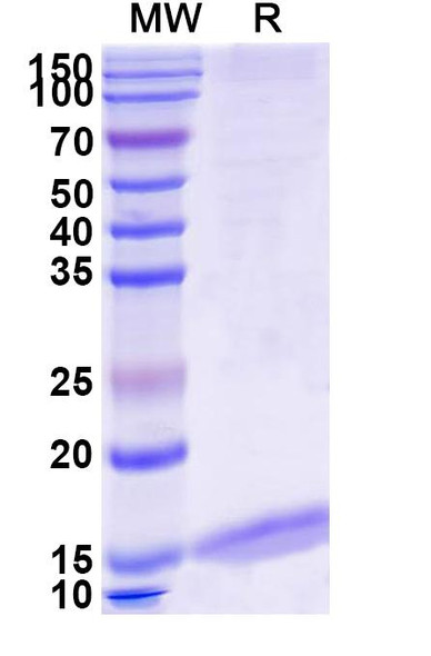 Anti-Mouse Albumin/Alb Recombinant Nanobody (MSA21) - SDS-PAGE