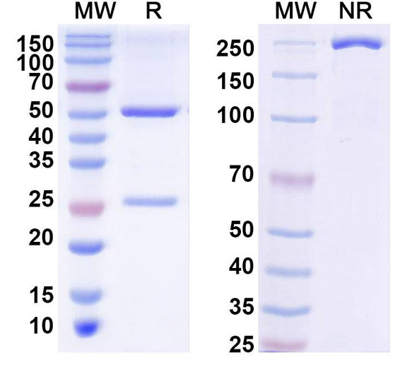 Anti-Phospho-Tau (pS396/pS404) Recombinant Monoclonal Antibody (PHF1) - SDS-PAGE
