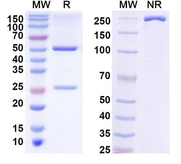 Anti-Phospho-Tau (pS202) Recombinant Monoclonal Antibody (CP13) - SDS-PAGE