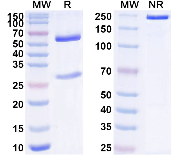 Anti-Human CD156b/ADAM17 Recombinant Monoclonal Antibody (SAA2069) - SDS-PAGE