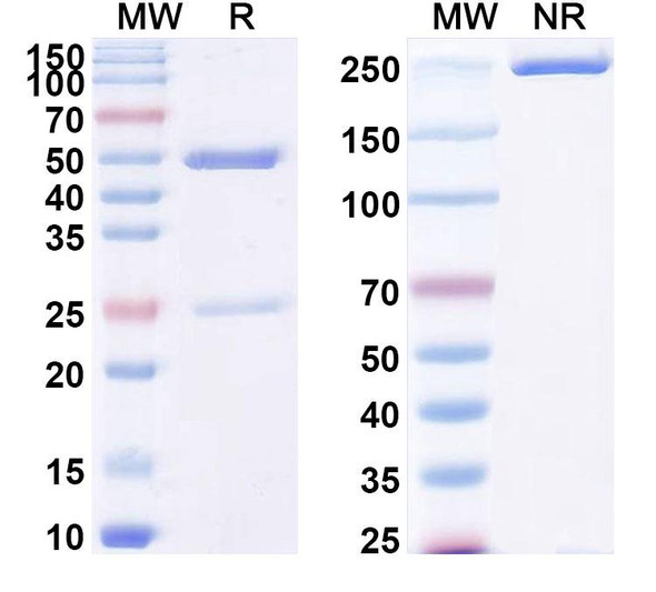 Anti-Human PODXL Recombinant Monoclonal Antibody (SAA2071) - SDS-PAGE